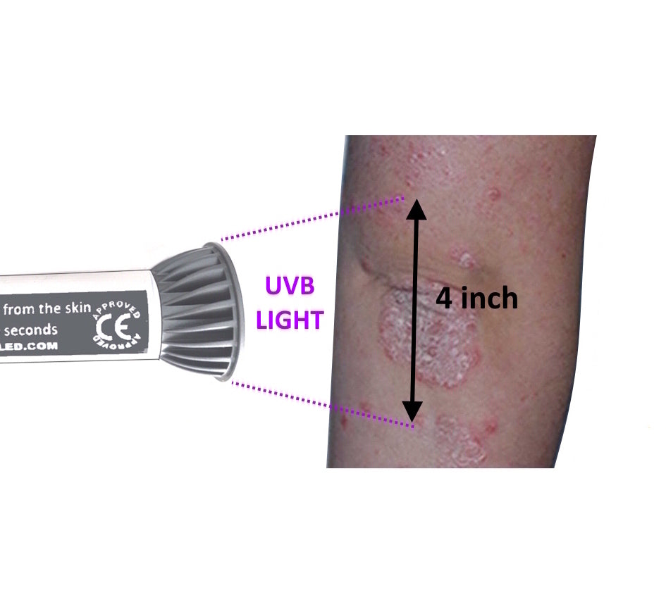 SKINCARE LAMP 2 MONTHS FREE USE 4 WATT