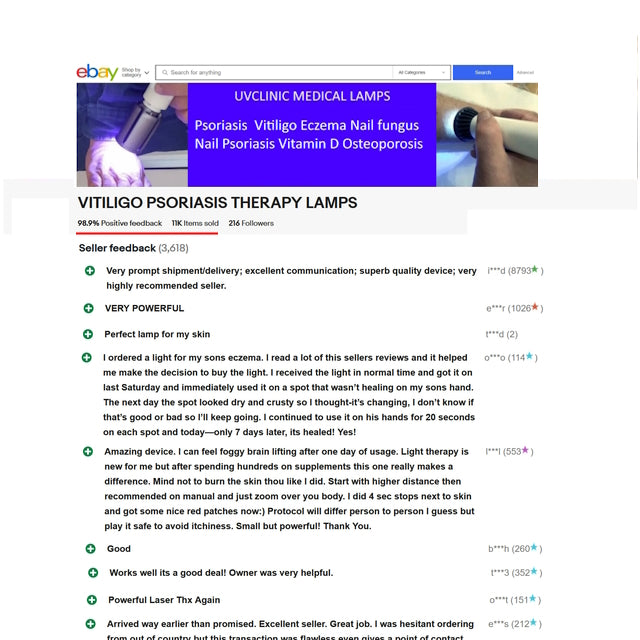 Psoriasis Eksem Vitiligo behandlingslampe