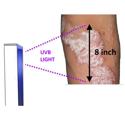 SKINCARE LAMP 2 MONTHS FREE USE 20 WATT