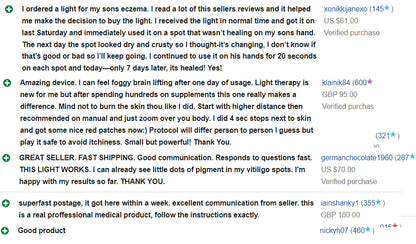 Psoriasis Eczema Vitiligo treatment USB lamp